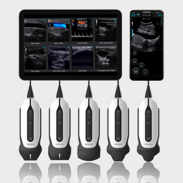 Ecógrafo Portátil Chison SonoEye + tablet Xiaomi Redmi Pad SE de REGALO Ecógrafo Portátil Chison SonoEye + tablet Xiaomi Redmi Pad SE de REGALO